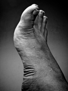 foot-3_stockphoto-624x831